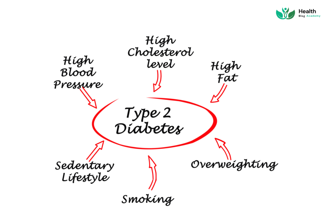 Causes of Type 2 Diabetes